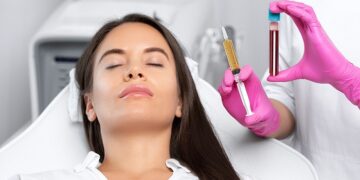 Benefits of plasma lifting procedure for beauty and health